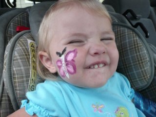 Butterfly cheek.